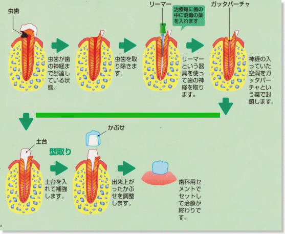 ̏ꍇ