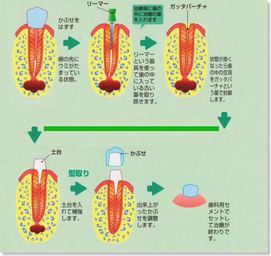 됫̏ꍇ